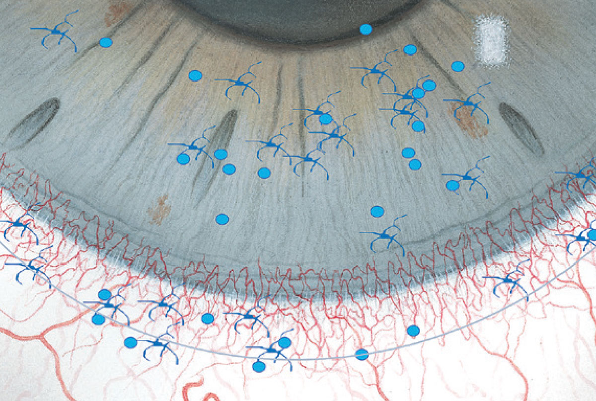 Contact Lens Spectrum | PentaVision