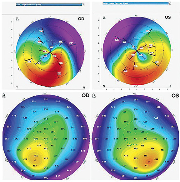 Contact Lens Spectrum PentaVision