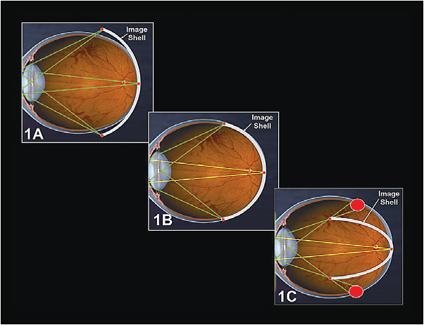 Contact Lens Spectrum | PentaVision