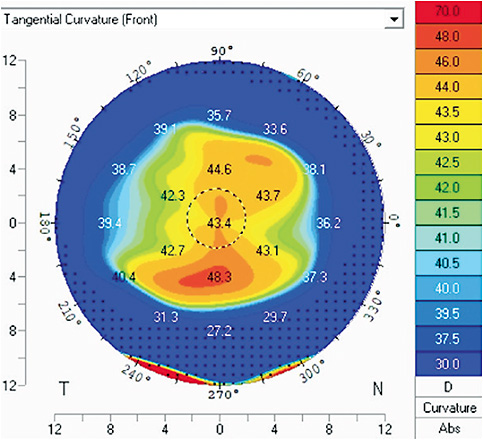 Contact Lens Spectrum | PentaVision