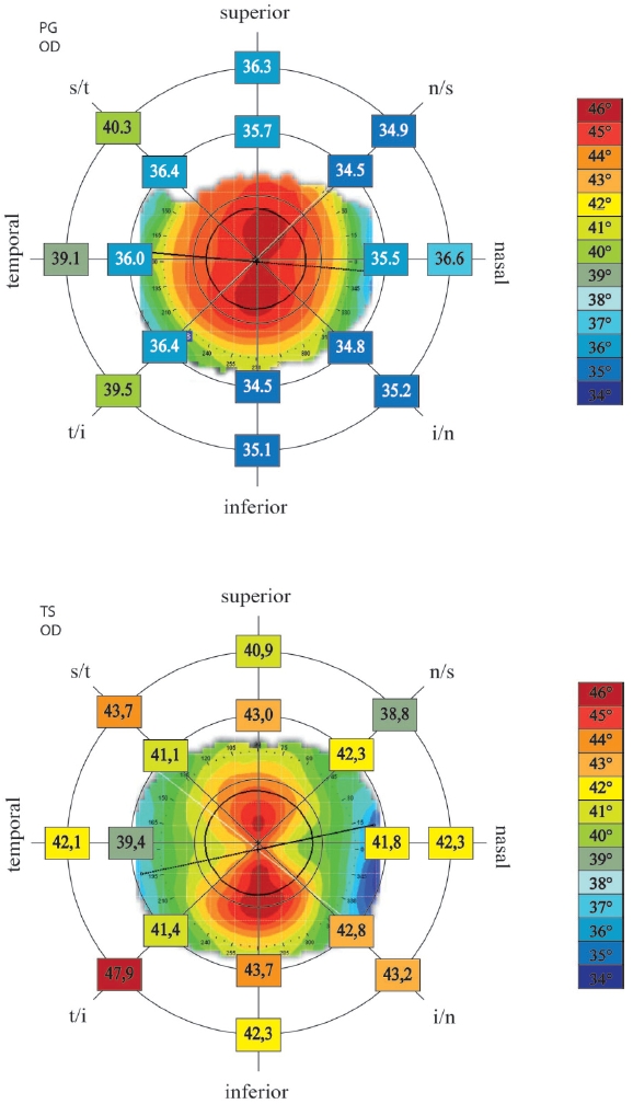 Contact Lens Spectrum | PentaVision