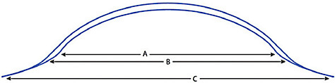 Figure 2. Anatomy of a scleral lens. A: Optical zone, B: Transition zone, C: Landing zone (Michaud et al, 2020).