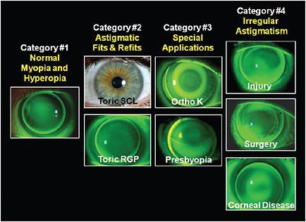 Contact Lens Spectrum | PentaVision