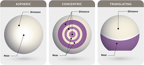 FIGURE 1. Images of aspheric, concentric, and translating multifocal designs.